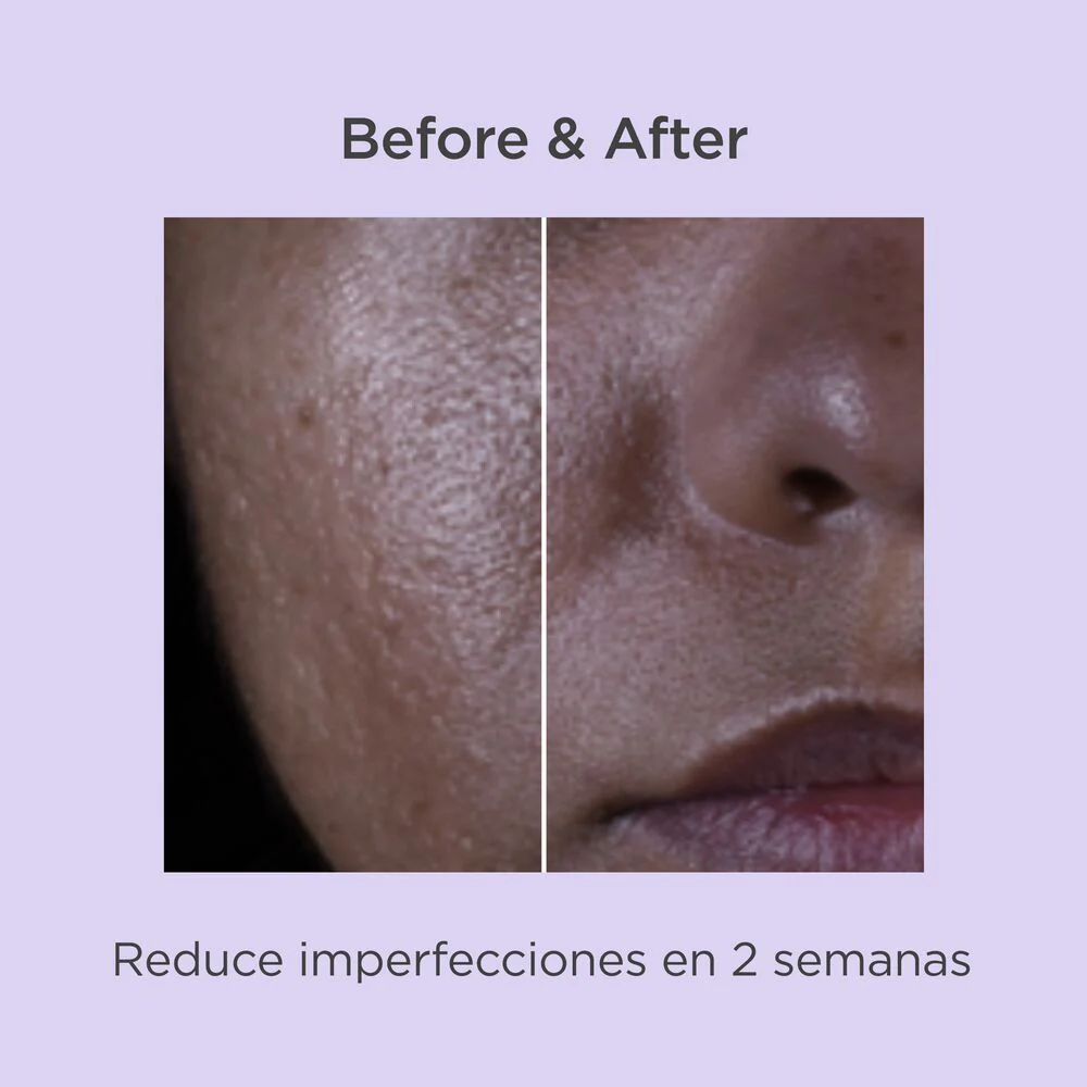 Suero Renovador Salicílico ISDINCEUTICS x30ml ISDIN® - Image 3