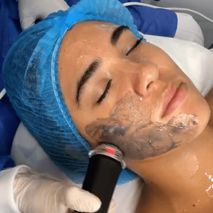 Oxygeneo® Super Facial: Exfolia, Nutre y Oxigena - 1 sesión